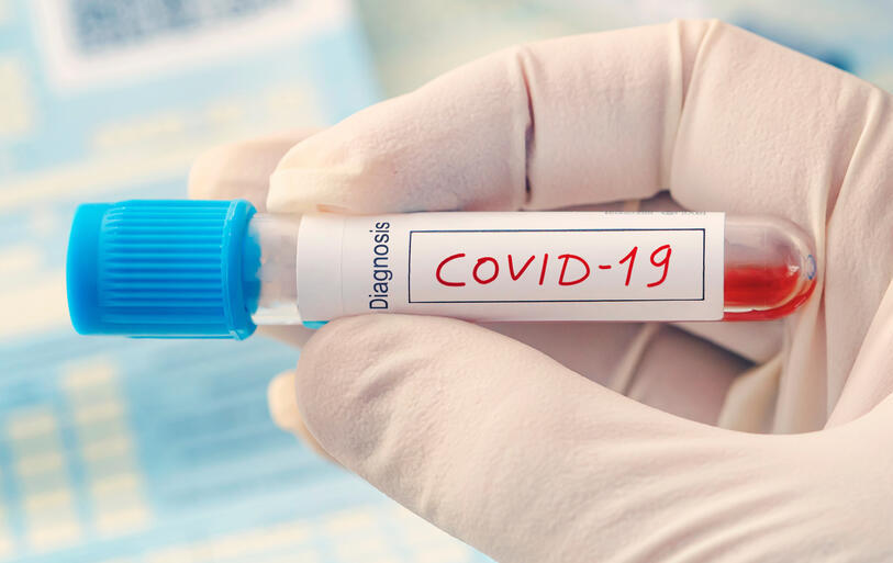identificata in Giappone una nuova variante del Coronavirus Covid 19 siglata E484K